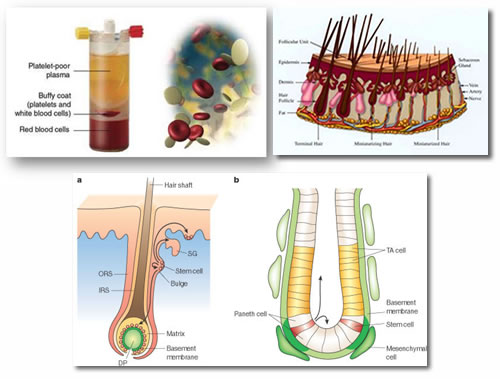 PRP-Hair-loss-treatment-Paphos